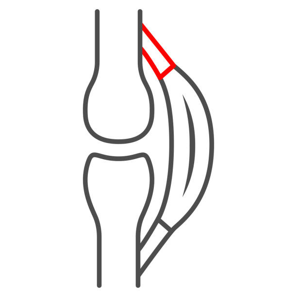 Ligament Injuries